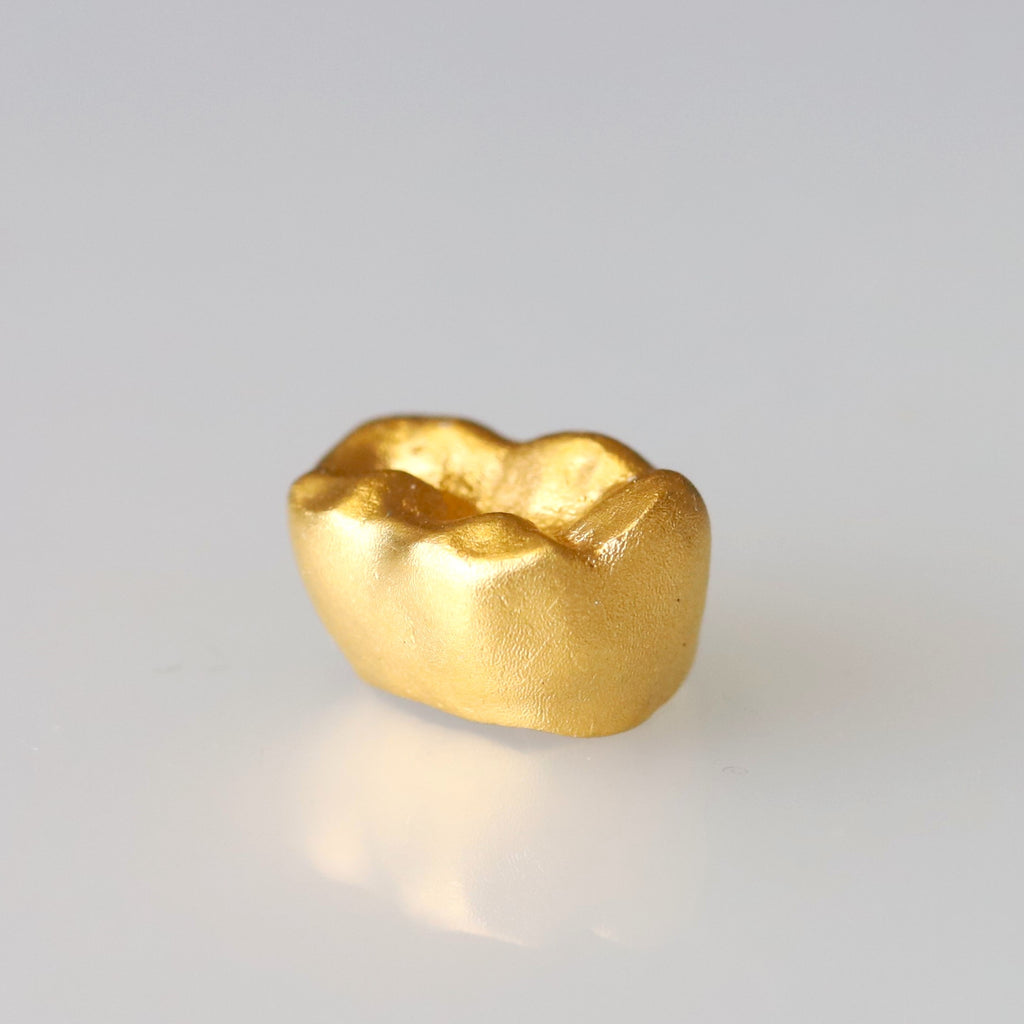 金乳歯(奥歯・ディスプレイタイプ）※金乳歯の素材費用は別途