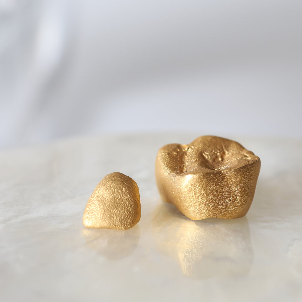 金乳歯(前歯・ディスプレイタイプ）※金乳歯の素材費用は別途